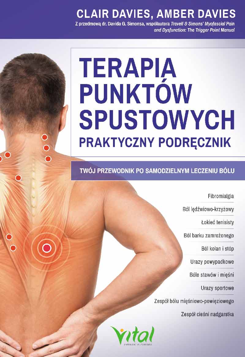 terapia punktów spustowych