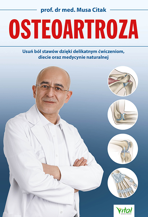 Osteoartoza-Musa-Citak