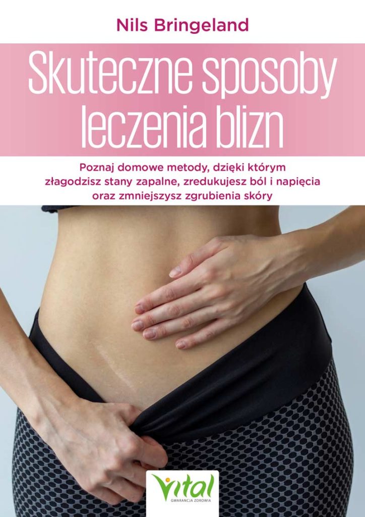Skuteczne sposoby leczenia blizn Nils Bringeland